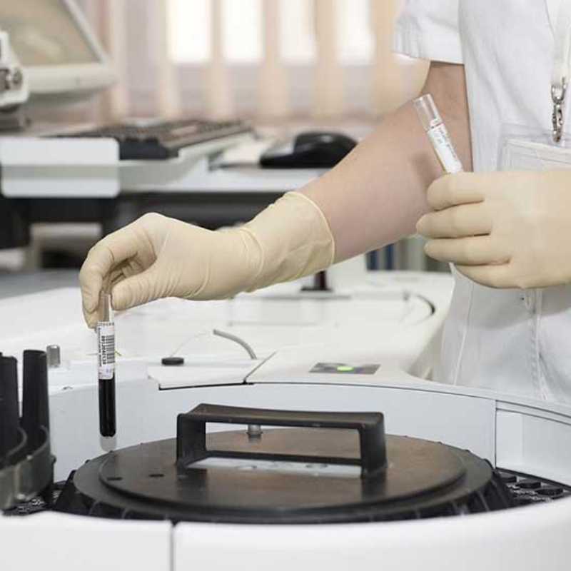 MATERIALES, EQUIPOS BASICOS DE LABORATORIO Y REACTIVOS