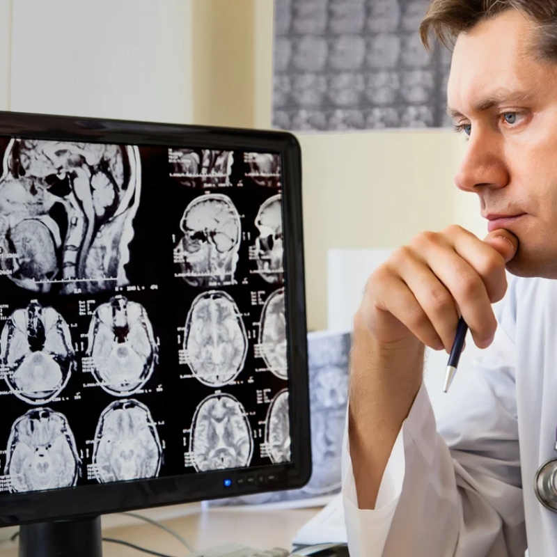 NOCIONES BÁSICAS EN RADIOGRAFÍA