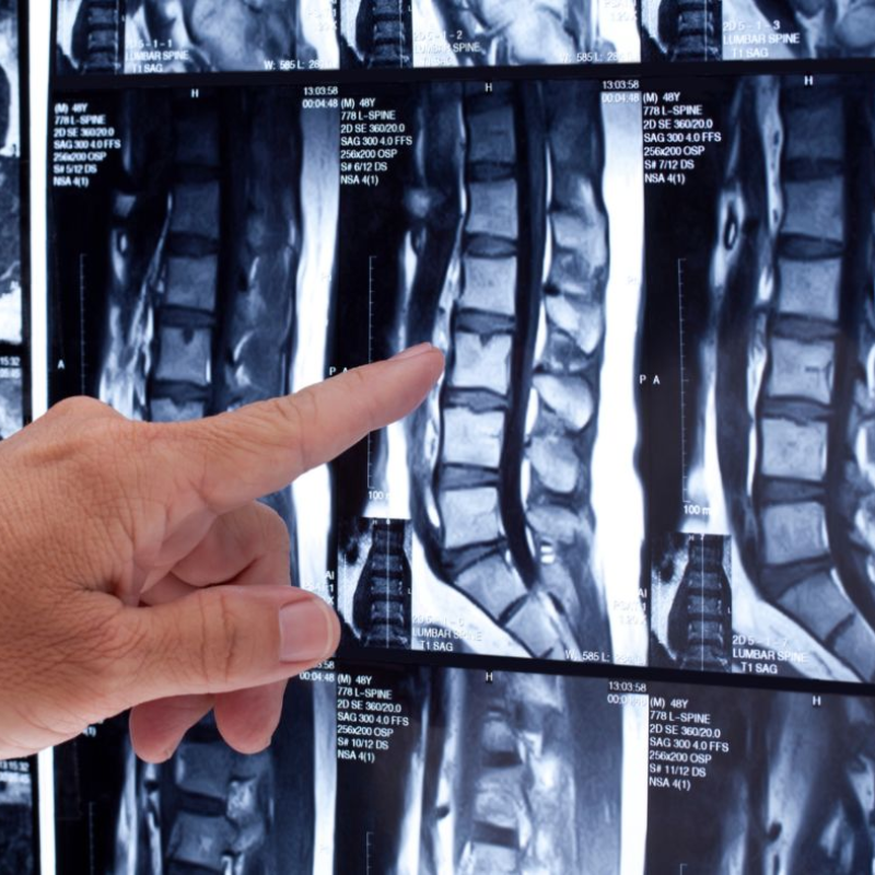 PRINCIPIOS DE RESONANCIA MAGNÉTICA Y SU SEGURIDAD