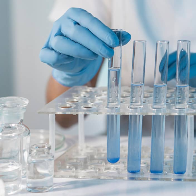 ACTIVIDADES EN LABORATORIO DE ANÁLISIS CLÍNICO