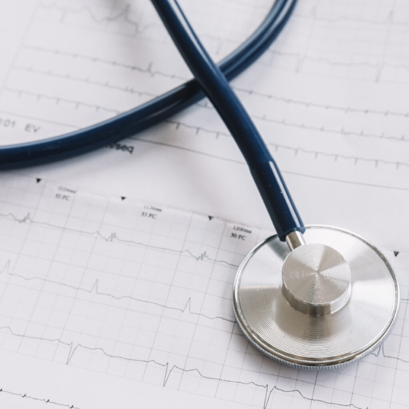 NOCIONES BÁSICAS DE ELECTROCARDIOGRAMA (SOLO TES Y TCAE)