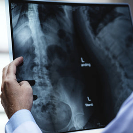 ANATOMÍA RADIOLÓGICA Y EXPLORACIONES ESPECIALES EN RADIODIAGNÓSTICO