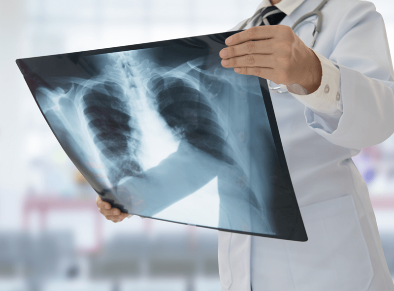 ANATOMÍA RADIOLÓGICA APLICADA AL RADIODIAGNÓSTICO